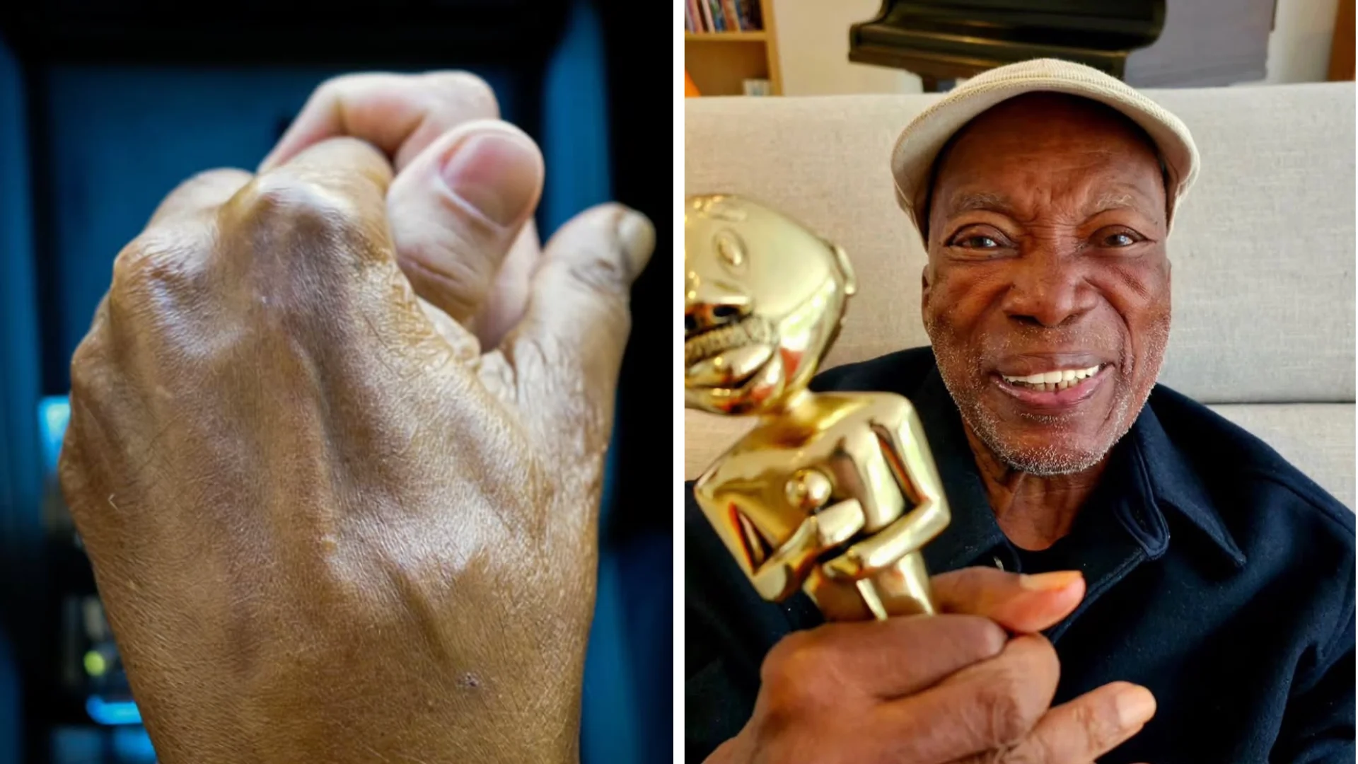 Milton Nascimento recebe alta e segue em recuperação em casa