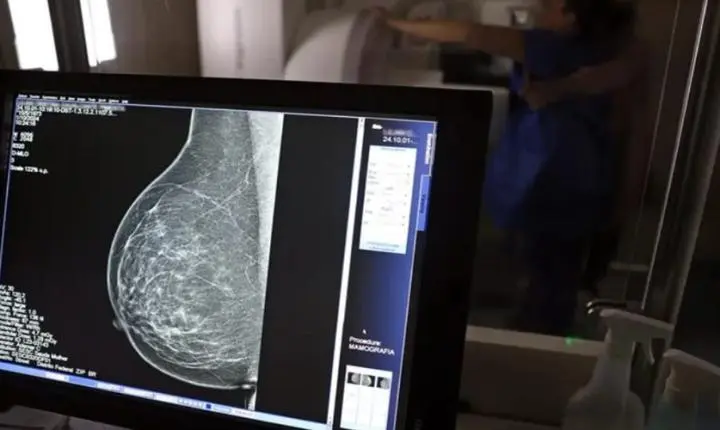 INCA alerta sobre câncer de mama agressivo e tardio em mulheres negras